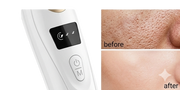 Electric Blackhead Remover Vacuum – Pore Cleaner & Acne Extractor Tool